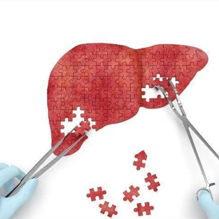 Chiết xuất thực vật Sửa chữa các lỗ hổng sức khỏe gan
